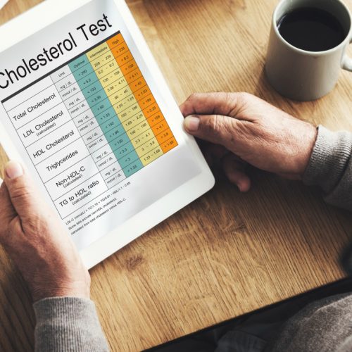 Cholesterolio profilis paprastai: LDL, HDL ir trigliceridai