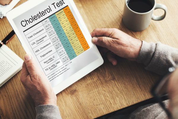 Cholesterolio profilis paprastai: LDL, HDL ir trigliceridai