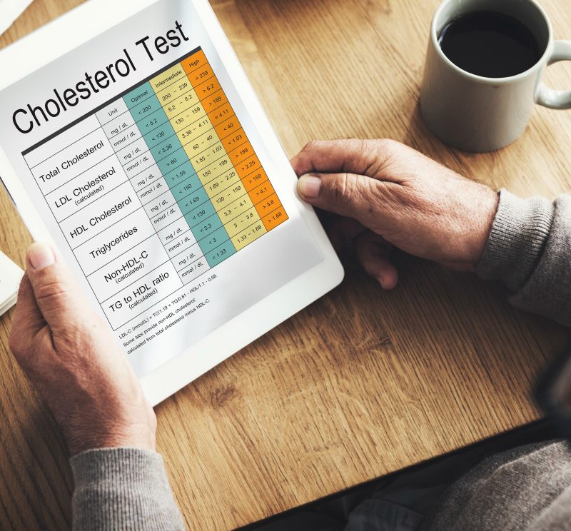 Cholesterolio profilis paprastai: LDL, HDL ir trigliceridai
