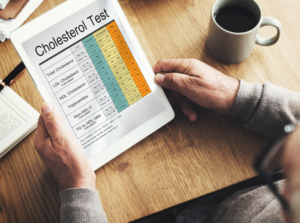 Cholesterolio profilis paprastai: LDL, HDL ir trigliceridai